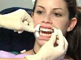 Photo of a dental tech applying retractors to a patient's mouth.