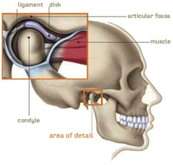 a dentist's color diagram of the human skull with a closeup of the TMJ joint, showing the disc that cushions the joint