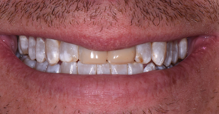 smile gallery teeth before